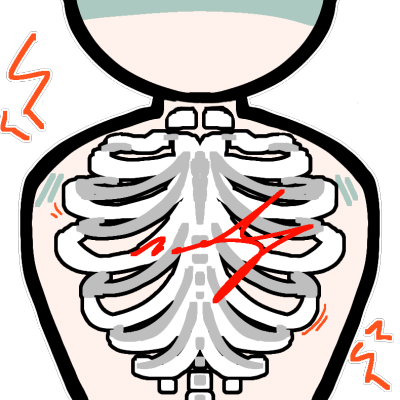 A ribcage in a torso with red pain lines radiating from it.